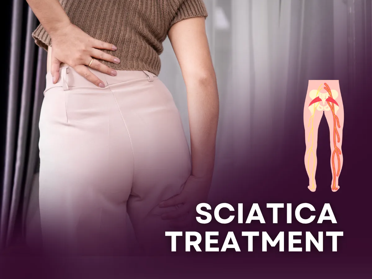 sciatica